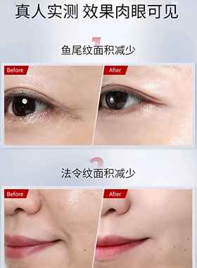 NTI白细胞奇迹肌活睡眠面膜熬夜救星抗皱涂抹式免洗补水夜间修复