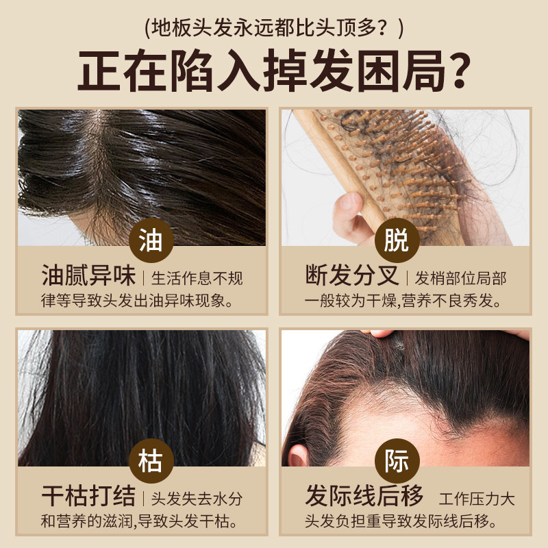 蜂花防脱洗发水露男女士九尊樽峰花 蜂花恋蝶洗发水