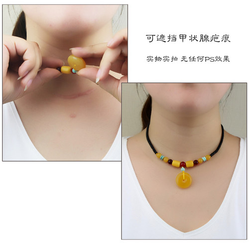 恒福隆蜜蜡平安扣锁骨链天然原矿牡丹花吊坠可遮挡甲状腺疤痕项链 - 图1