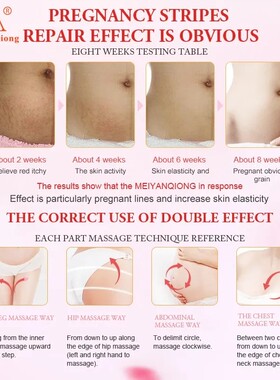 Skin Smooth Repair Cream Remove Stretch Mark祛妊娠纹霜身体乳