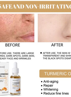 Turmeric Dark Spot Correcting Serum Face Care Spot Moisturis