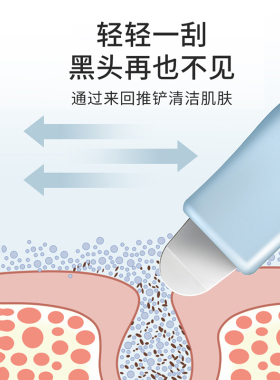 超薄黑头铲手动清洁毛囊去鼻子黑头神器美容院用清理暗疮粉刺痘痘