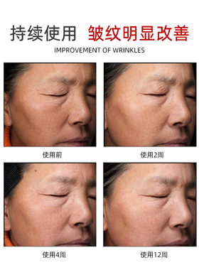 霖家a醇精华淡化细纹紧致抗皱抗老视黄醇蛇毒肽鲜活维A精华乳面部