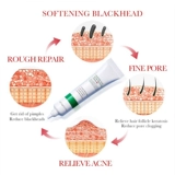 20 гс ali cy cac id Удаление угрей Установка