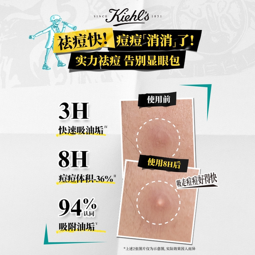 【重磅新品】科颜氏「消消乐」隐形痘痘贴超薄防翘边控油舒缓祛痘 - 图0