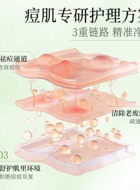 韩伦美羽专研祛痘精华液修护痘肌泛红痘印痘坑闭口粉刺祛痘膏原液