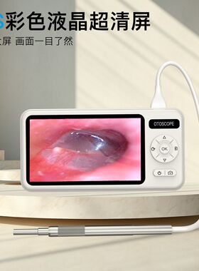 高清可视采耳工具5寸掏耳