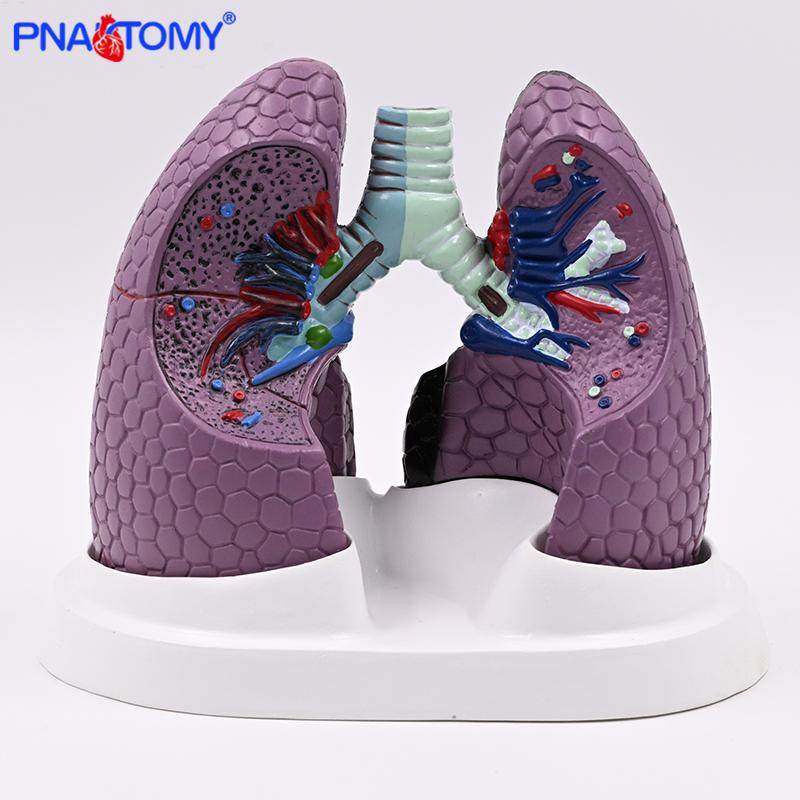 人体肺模型 吸烟病变肺 呼吸科标本健康肺胸外科肺部解剖健康教学 - 图3