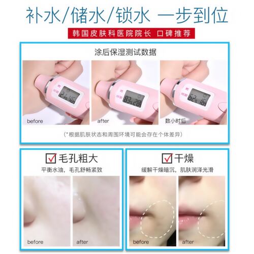 韩国梦诗肌Dream Skin维他命B5保湿补水精华 解救缺水敏感肌锁水 - 图2