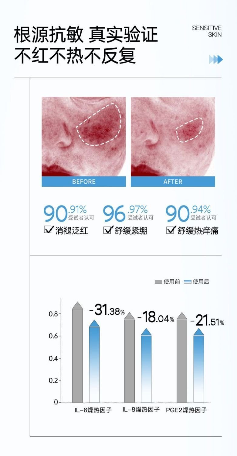 小猫安妮舒敏仪冰电波美容仪修护屏障舒缓嫩肤美白敏感肌家用 - 图2