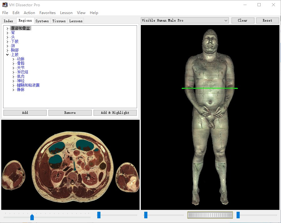 虚拟人体断层解剖软件VH Dissector Pro V4.5.2中英双语版 - 图1