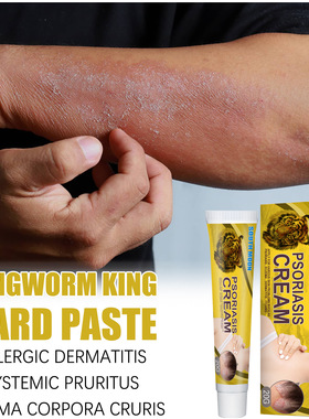 Surface Gentle Care Cream Body Surface Moisturizing And Mois