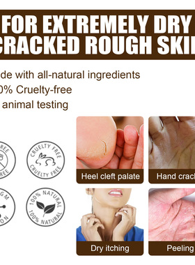Rough Heel Cream Heel Care Gentle Care Lightness Rough Water