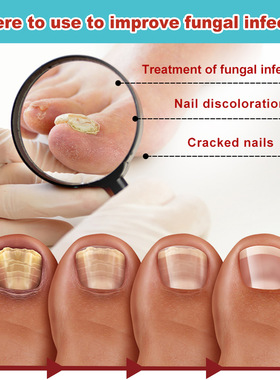 Nail Curing Paste Shui Yang Transparent Curing Nail Caste To