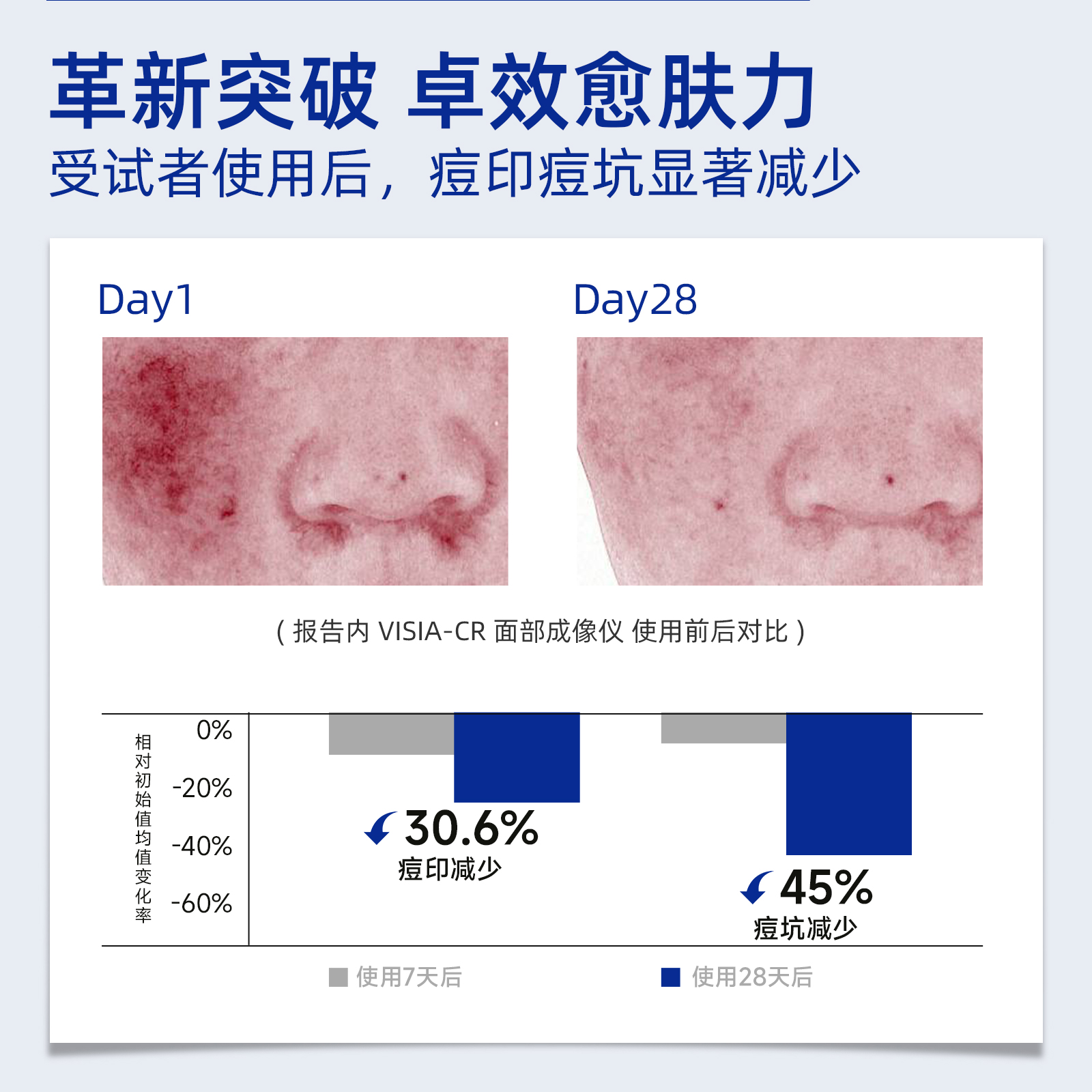 vk医用硅酮贴vaki硅酮贴痘印痘坑淡化红黑褐痘印痘疤凹洞改善