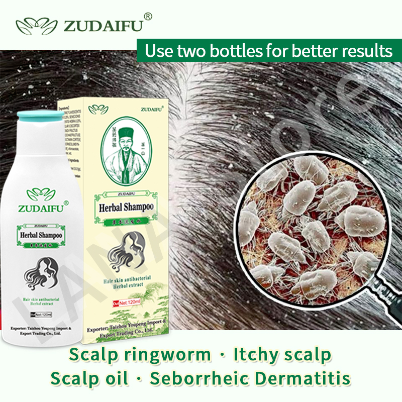 Zudaifu Compound Herbal Shampoo Psoriasis Seborrheic Skin Ca - 图0