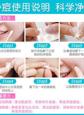 护妍天使去粉刺隐形产品痘痘贴