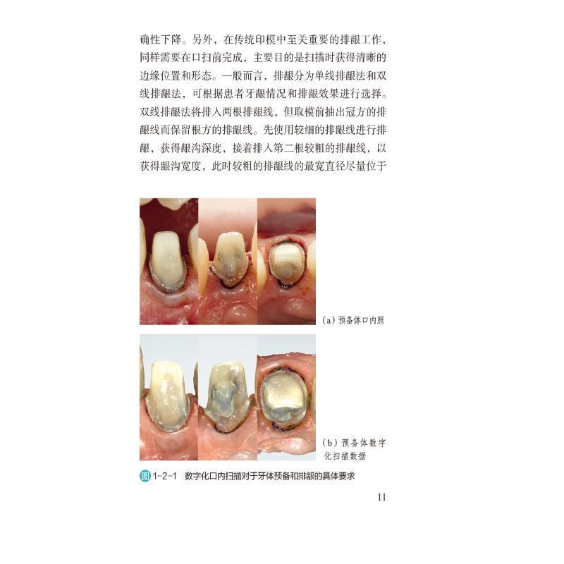 书籍正版 口扫与面扫、调(牙合)与上(牙合)架的实操规范 谢璐 中国医药科技出版社 自由组套 9787521444322 - 图0