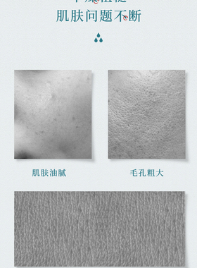 兰贵妃玫瑰纯露100ml保湿喷雾补水云南高原玫瑰