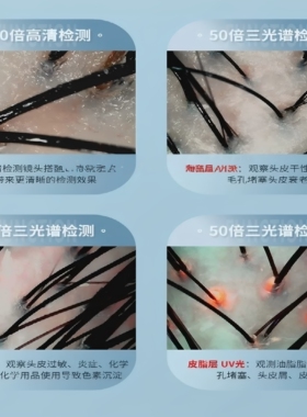 高清头皮检测护理按摩一体机仪器