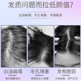 L'Oreal, шампунь с гиалуроновой кислотой, масло в ампулах, кондиционер, комплект для путешествий, контроль жирного блеска, придает объем, пробник