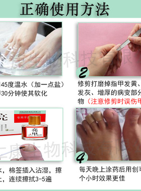 坏指甲空甲肉分离修复亮甲专用液