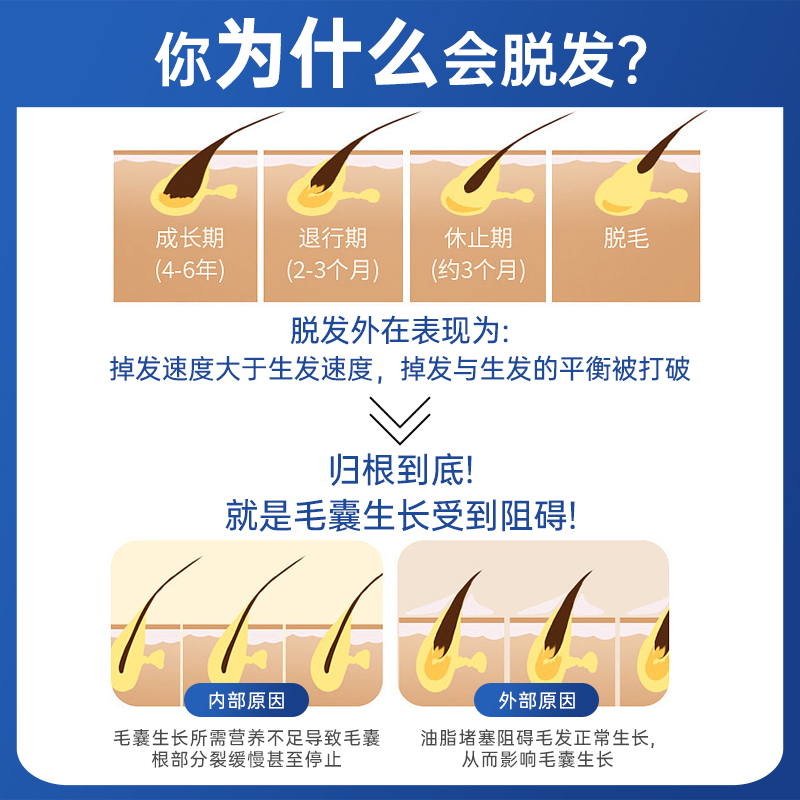 霸王育发液防脱发控油柔顺头发增固发液头皮营养液官网正品-图0