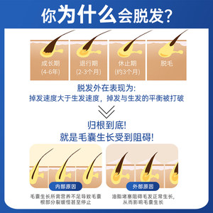 霸王育发液防脱发控油柔顺头发增固发液头皮营养液官网正品