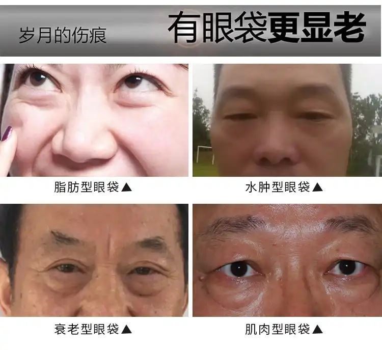 中年爸爸男人祛眼带眼袋熬夜男士护眼霜中老年抗皱纹去除眼霜正品
