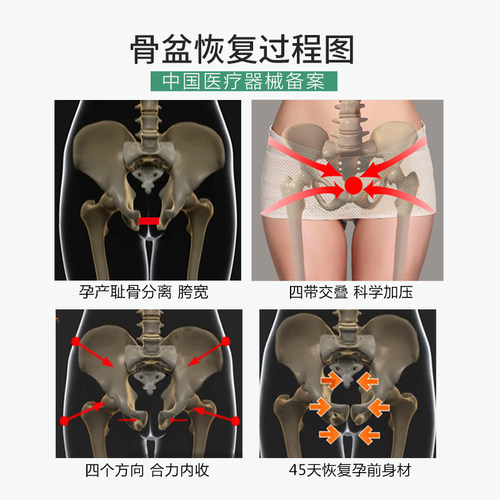 骨盆矫正带产后恢复双菱形骨盆带收腹收胯提臀塑身耻骨分离盆骨带-图1