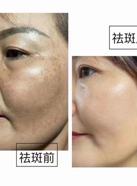 黄芪霜日晚霜醋疗打底拉丝霜草本