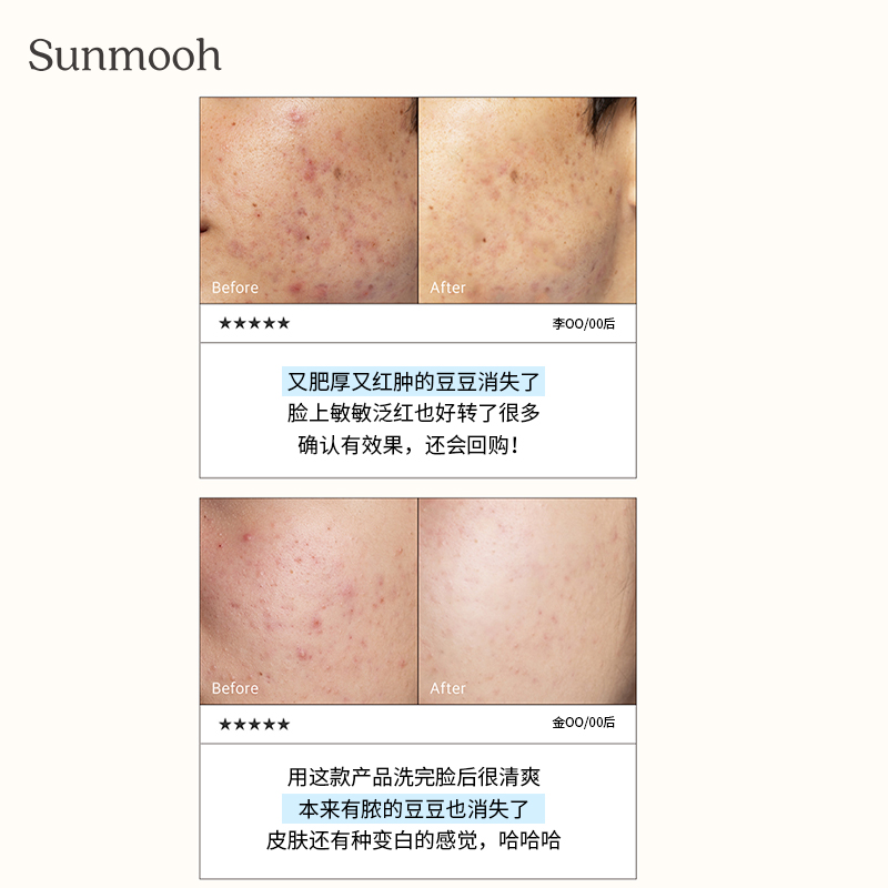 【Sunmooh】温和祛痘洁面LICORNE啫喱洗面奶果酸去粉刺闭口敏感肌-图2