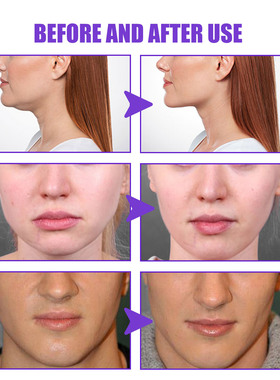 AntiWrinkleEssenceInstant