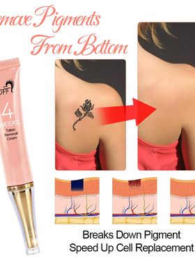4 Week Tattoo Removal Cream Permanent Moisturize Skin Tattoo