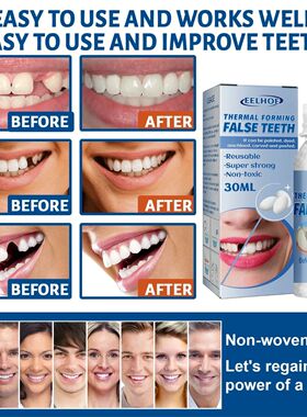 30ml Temporary Tooth Repair Kit Teeth And Gaps FalseTeeth So