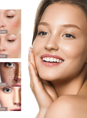 WhiteningFreckleCream