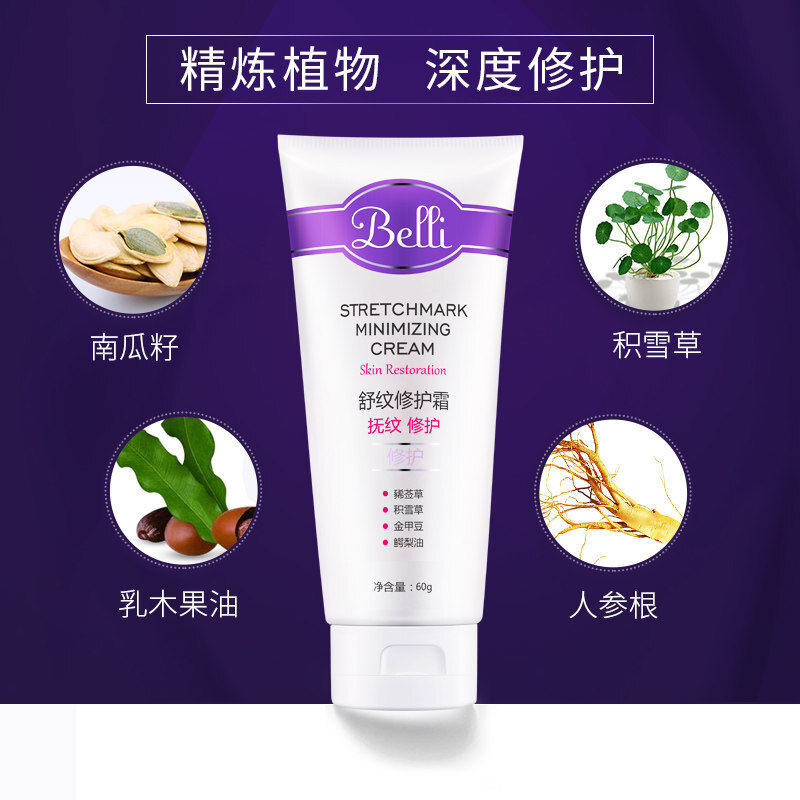  中亿家园母婴妊娠纹护理