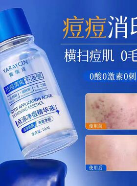 水杨酸精华淡化痘印精华液积雪草壬二酸去痘控油保湿烟酰胺爽肤水