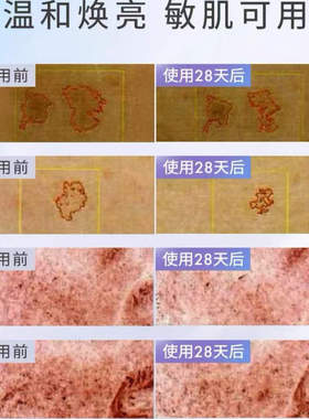 咨询优惠正品amilera聚光瓶精华