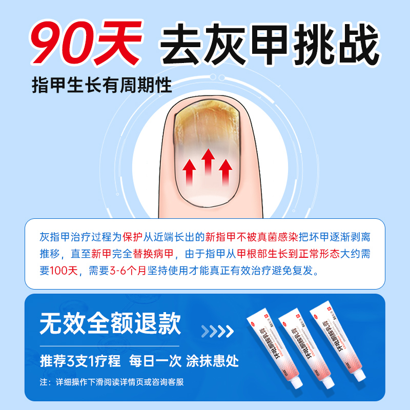 环吡酮胺乳膏30g/盒特灰指甲治疗专用药正品旗舰店效正品灰指甲药