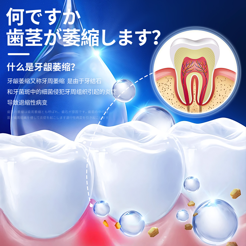 日本医用脱敏牙膏牙龈护理出血肿痛消炎萎缩牙齿疼治牙龈周炎专用