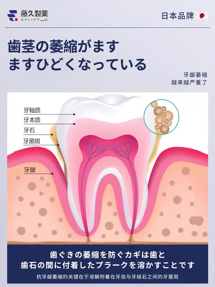 牙刷软毛牙周炎牙缝刷小头牙齿敏感专用松动固齿脱敏牙膏牙龈出血 - 图1