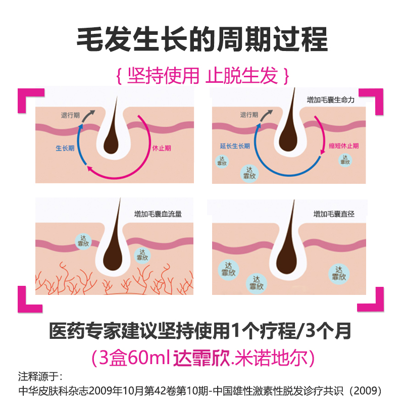 振东旗舰店米诺地尔搽剂非洗发水增发防脱发脂溢性脱发药育发生发液男生女生2