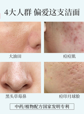 瓷律清肌清洗面奶控油深层
