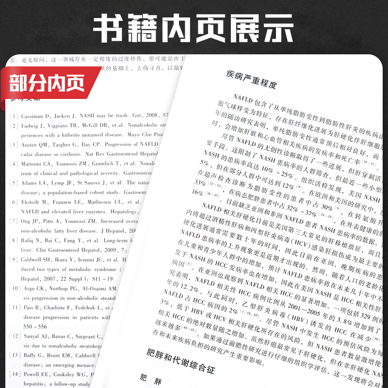 非酒精性脂肪性肝病的临床困境 隐源性肝硬化纤维化进展肝活检的组织学评估肠道微生物肝移植脂肪性肝炎分子靶向胰岛素 临床医学 - 图2