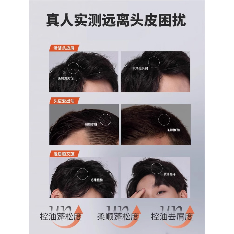 洗发水男士专用去屑止痒控油蓬松氨基酸香氛洗发露沐浴露套装正品