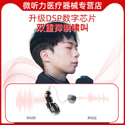 西万拓格纳助听器源德国充电老年人专用正品年轻耳聋耳背蓝牙小巧 - 图2