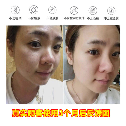 【官方店铺】TST庭秘密洁面乳冰肌如玉靓肤洗面奶控油 - 图0