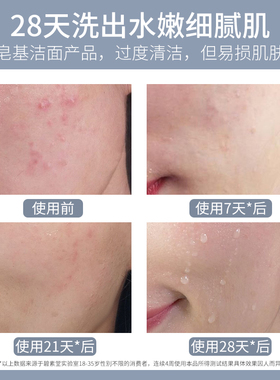 500毫升氨基酸净颜洗面奶保湿控清洁毛孔除螨洁面乳洁面泡美容院