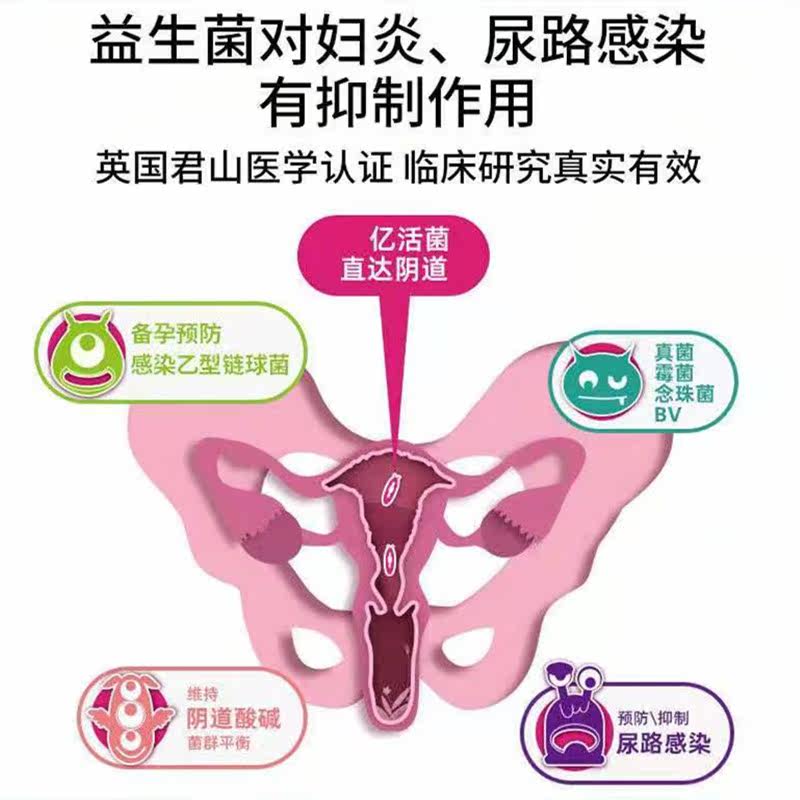 阴道乳杆活菌乳酸杆菌凝胶官网胶囊 睿远医疗器械私处护理
